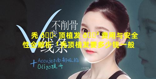 秃 🌷 顶植发 🌲 费用与安全性全解析「秃顶植发要多少钱一般」